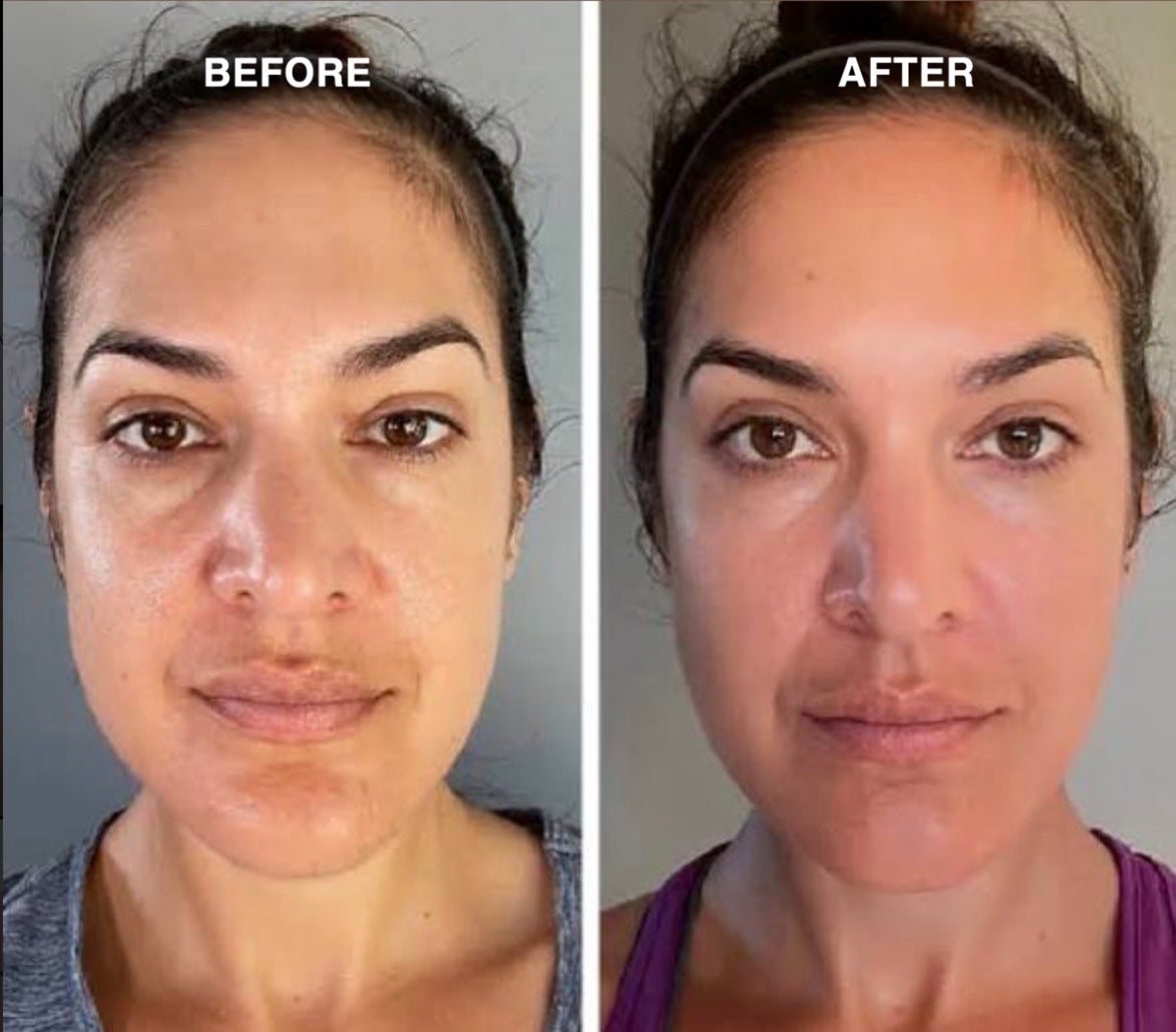 Cradlelux Gua Sha Brush